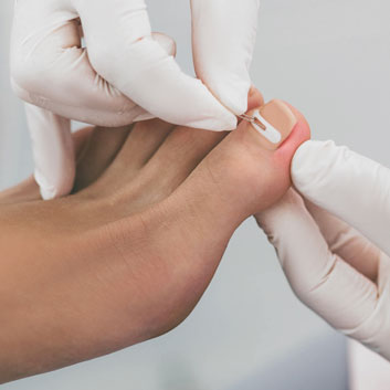 Nahaufnahme einer intensiven Fußpflegebehandlung